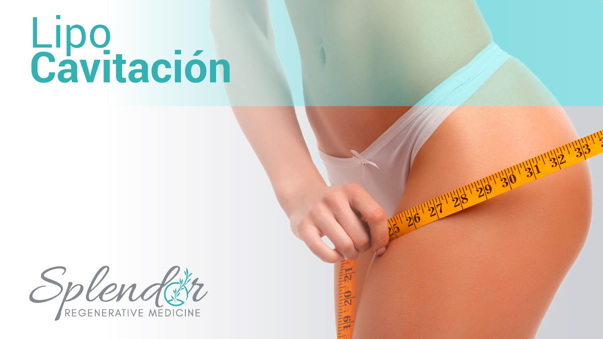 Lipo Cavitacion