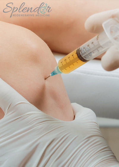 PRP Treatment in South Miami - Splendor Regenerative Medicine