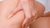 What is cellulite?